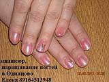 укрепление биогелем, покрытие лаком