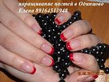 укрепление биогелем, френч