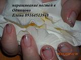 укрепление биогелем, френч миллениум